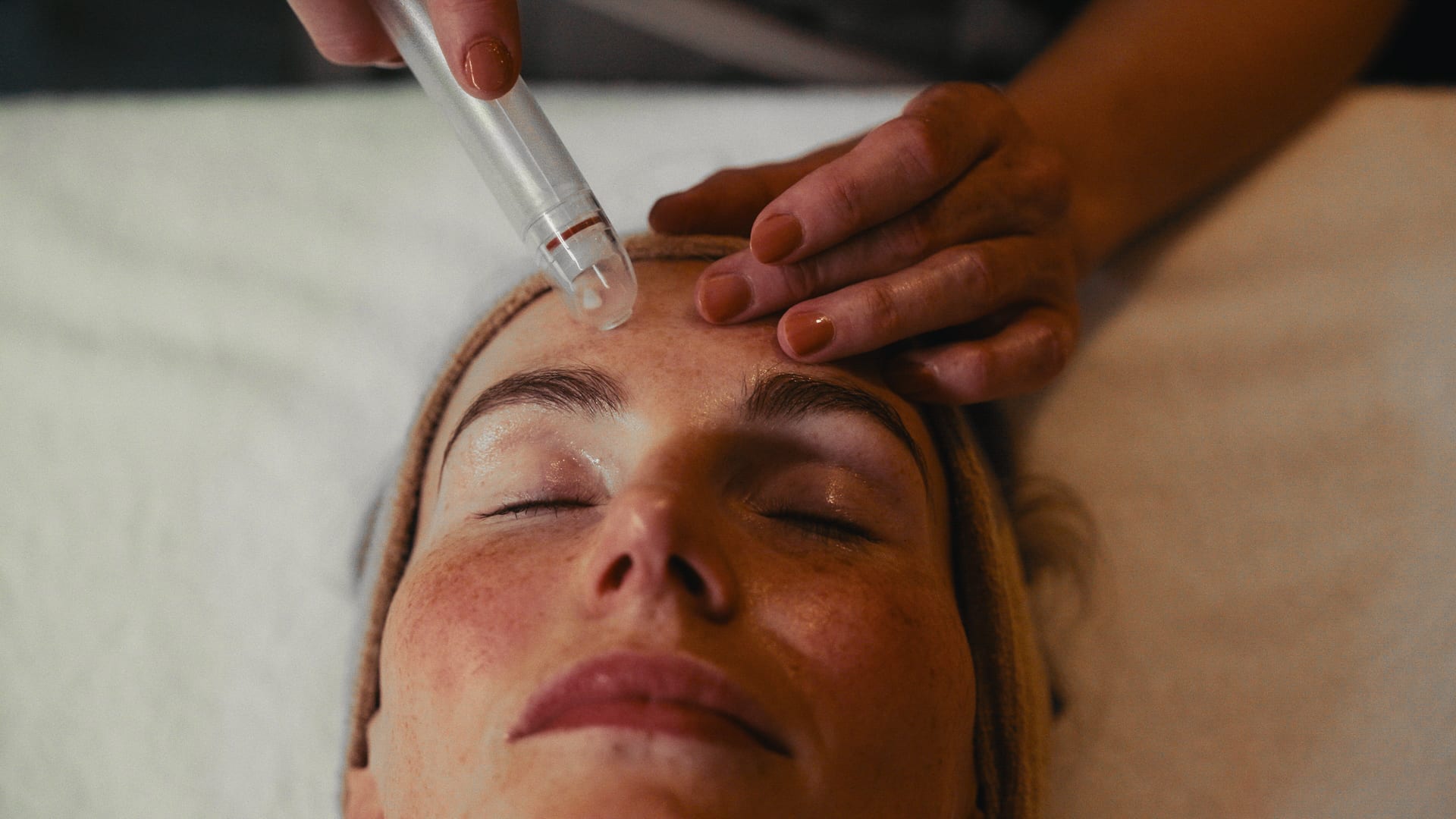 Microdermabrasie